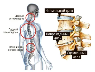 Книга Здоровье позвоночника Упражнения от болей в шее и спине при  остеохондрозе и межпозвоночных грыжах Золотая книга Сергей Бубновский -  купить от 1 044 ₽, читать онлайн отзывы и рецензии | ISBN 978-5-04-191555-1  | Эксмо