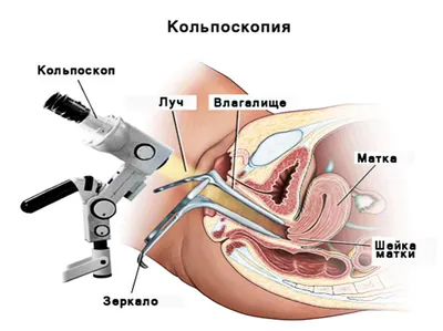 Осмотр детского гинеколога: процедура, причины, последствия