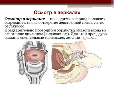 Зеркало гинекологическое \"MEDICARE\" (стерильное, одноразового  использования, ступенчатый тип соединения) размер M Медтехника Мед1.ltd