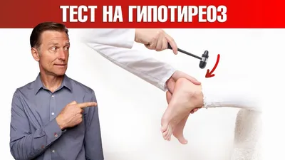 Гипотиреоз 4. Лечение гипотиреоза без тироксина - YouTube