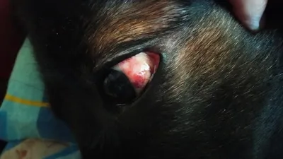 Проптоз (выпадение) глазного яблока/ Proptosis of eyeball