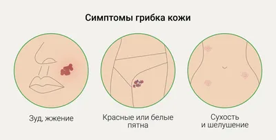 Грибок ногтей, лечение. Причины и симптомы грибка ногтей.