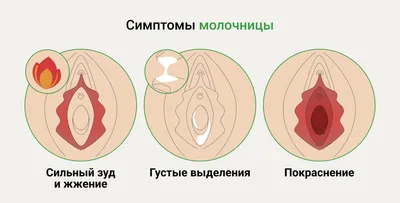 Бляшки на коже - причины появления, при каких заболеваниях возникает,  диагностика и способы лечения