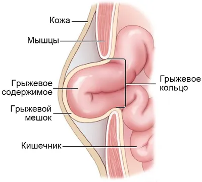 Хирургическая коррекция наружных грыж брюшной стенки у собак и кошек |  Ветеринарная клиника доктора Шубина