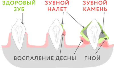 Чистка зубов собаке без наркоза УЗ | Москва, Фили | Зоосалон у Мишки