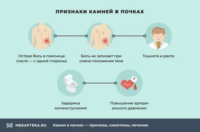 Откуда берутся камни в почках?