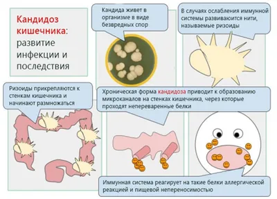 Ученые выяснили, что бездомные собаки могут быть переносчиками смертельно  опасного грибка