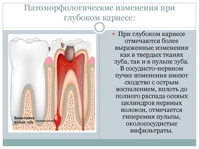 Кариес \"дырка\" в зубе. Как обнаружить и зачем нужен рентгеновский снимок?  Некариозные поражения. | Правдивая стоматология доктора Аболмасова | Дзен