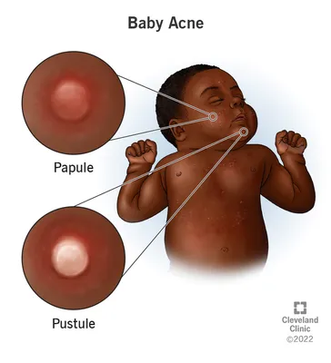 Stage 2 baby food: When is a child ready to try a bit more texture?