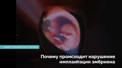 Что происходит в Донбассе и возможна ли там дальнейшая эскалация — РБК