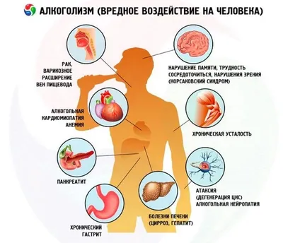 Сплошной вред и никакой пользы: как алкоголь влияет на жизнь?