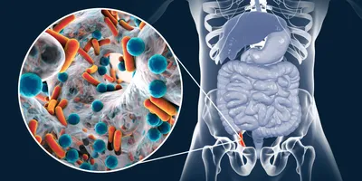 Аппендицит: симптомы, признаки, с какой стороны болит, операция по  удалению, как определить