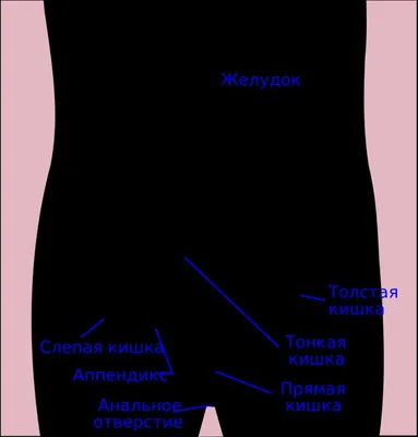 Аппендицит: диагностика и лечение в Киеве ~ МЕДИКОМ