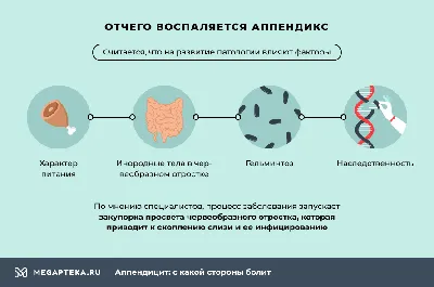 Аппендэктомия (удаление аппендицита) в Киеве - рядом с метро Житомирская –  Uclinic