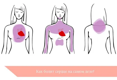 Может ли болеть сердце? | Блог о здоровье «Рэмси Диагностика»