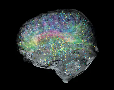 BRAINMAPS.ORG - BRAIN ATLAS, BRAIN MAPS, BRAIN STRUCTURE, NEUROINFORMATICS,  BRAIN, STEREOTAXIC ATLAS, NEUROSCIENCE