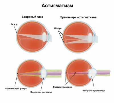 Стереокартинки для тренировки глаз