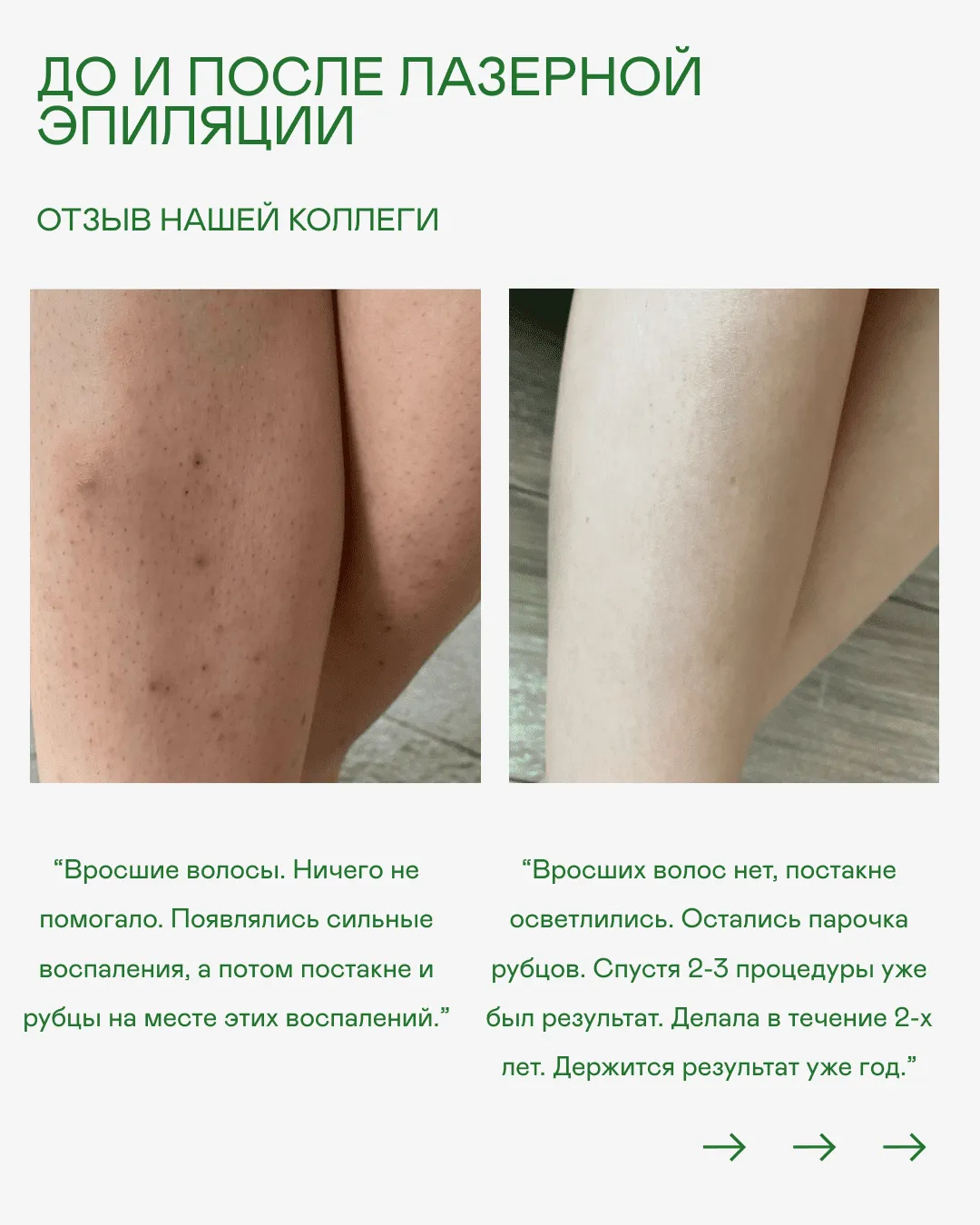 Лазерная эпиляция в Калининграде - Эффективно и безопасно. Клиника «Лазерная медицина» Лазерная эпиляция в Калининграде - Эффективно и безопасно. Клиника «Лазерная медицина»