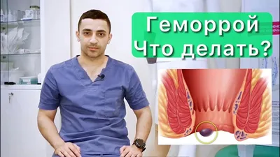 Лечение геморроя – лучшие клиники в Москве • Русский Доктор