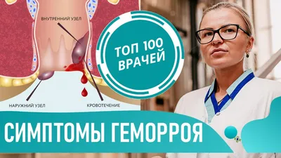 Геморрой - симптомы, лечение, причины и профилактика геморроя - Гармония