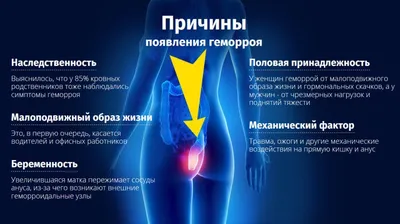 Как выглядит ГЕМОРРОЙ: фото 1-4 стадии. Симптомы геморроя у мужчин и женщин  - YouTube