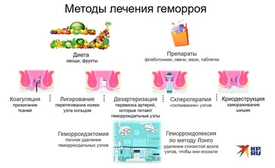 Самые эффективные свечи от геморроя - статьи от компании Еламед