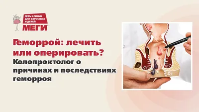 Геморроидэктомия - золотой стандарт лечения геморроя. ⠀ | Клиника Medimax в  Ташкенте