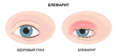 Какие цветные линзы подойдут для карих глаз: секреты колористики и как  выбрать? | Блог Colorlens24