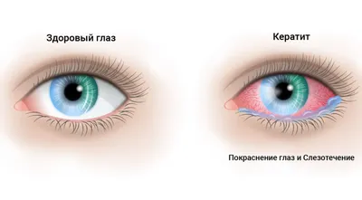 Строение глаза – полезная информация на сайте офтальмологического центра  VISTA.