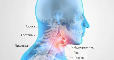 Ангина: причины, симптомы, лечение - МедКом