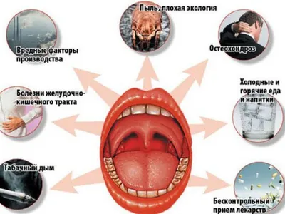 Болезни горла: виды и причины, хронические и инфекционные заболевания горла,  симптомы, читайте в статье блога Furasol®