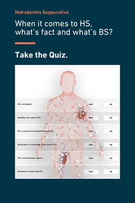 Hidradenitis Suppurativa (HS) Hair Removal