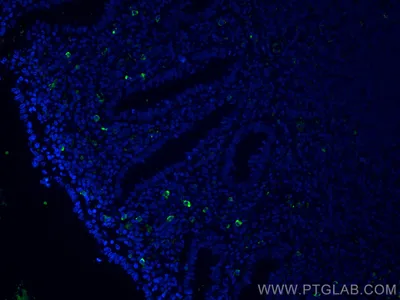 Types of antibodies. IgG, IgM, IgA, IgD, IgE Stock Vector | Adobe Stock