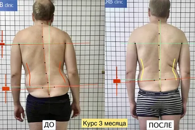 Результаты лечения