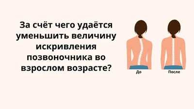 Сколиоз - Быть здоровым - это элементарно - УЗ \"16-я городская поликлиника\"