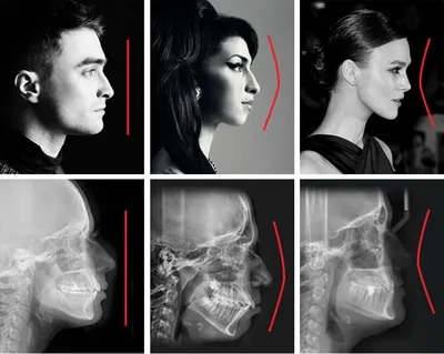 Человек Профиль Лицо Фотография, картинки, изображения и сток-фотография  без роялти. Image 72799682