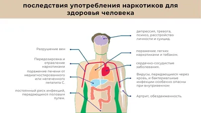 Власть прощупывает почву? Эксперты не исключают легализацию наркотиков в  Армении - 08.05.2023, Sputnik Армения