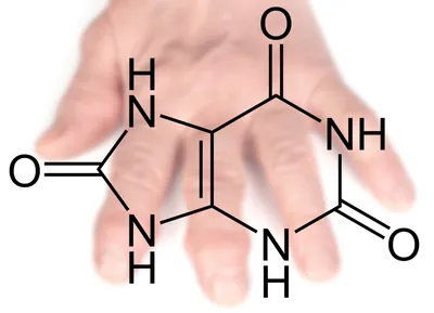 Подагра: что за болезнь, признаки, симптомы, лечение мужчин и женщин,  обострения, диета