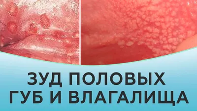 Нарисованные вручную секционированные половые губы в обнаженном векторе  цвета Parted глянцевость цвет губ половых губ бежевый Губ Иллюстрация штока  - иллюстрации насчитывающей лоск, цвет: 198738032