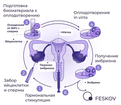 ЭКО для ВИЧ-инфицированных | Клиника ЭКО профессора Феськова