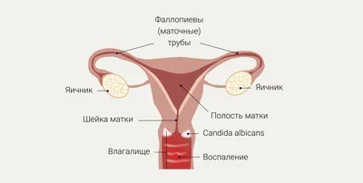 Зуд и жжение в интимном месте: причины, лечение, препараты