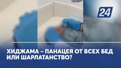 Что такое хиджама? | Сообщество молодых докторов | Дзен