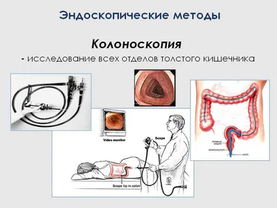 Кишечник Человека Анатомия — стоковые фотографии и другие картинки Анатомия  - Анатомия, Аппендикс, Вертикальный - iStock