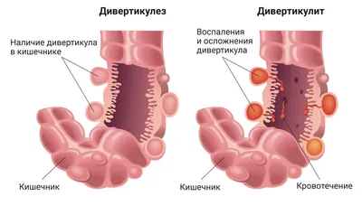 Желудок человека, маленький кишечник и толстая кишка 3D Модель $89 - .3ds  .blend .c4d .fbx .ma .obj .max - Free3D