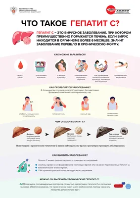 Физкультура и лфк после инсульта - упражнения, зарядка