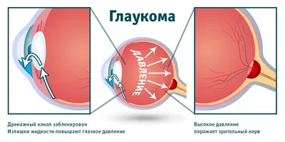 Библиотека пациента: кардиология | ФГБУ «Поликлиника №1» Управления делами  Президента Российской Федерации