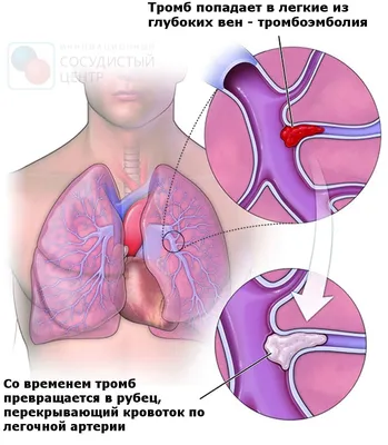 Что такое гимнастика цигун? Китайская методика оздоровления, упражнения для  похудения - Чемпионат