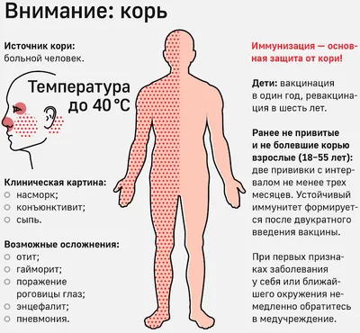 Корь у детей: Вспышка кори в России в 2023 году 🤒 - Евромед Кидс