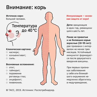 РЕКОМЕНДАЦИИ ГРАЖДАНАМ: корь