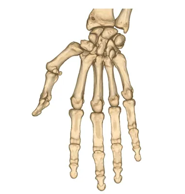 Кости кисти - e-Anatomy - IMAIOS